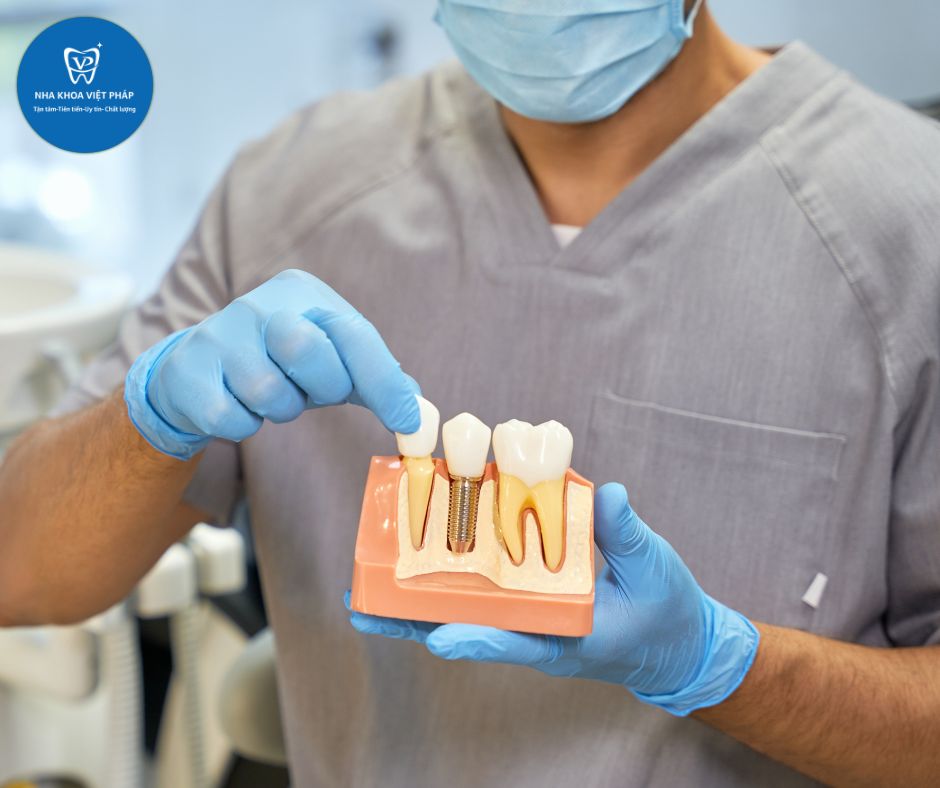 TRỒNG RĂNG IMPLANT TẠI NHA KHOA VIỆT PHÁP QUỐC OAI